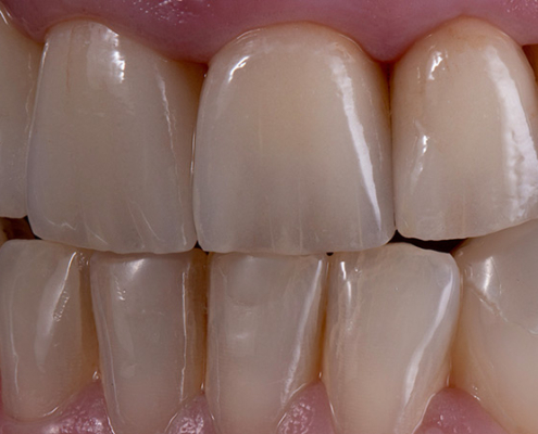 Frontalansicht Zähne