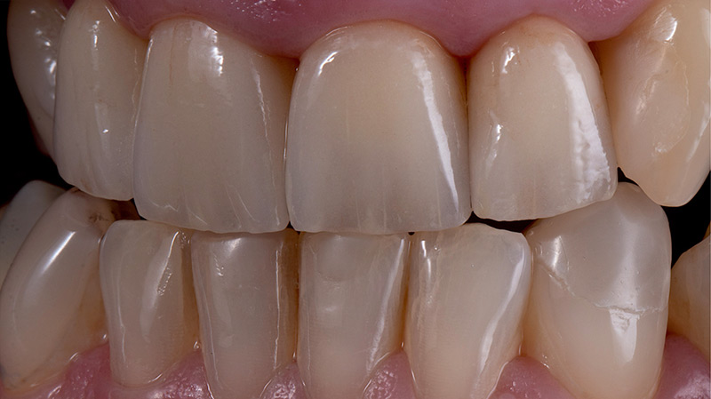 Frontalansicht Zähne