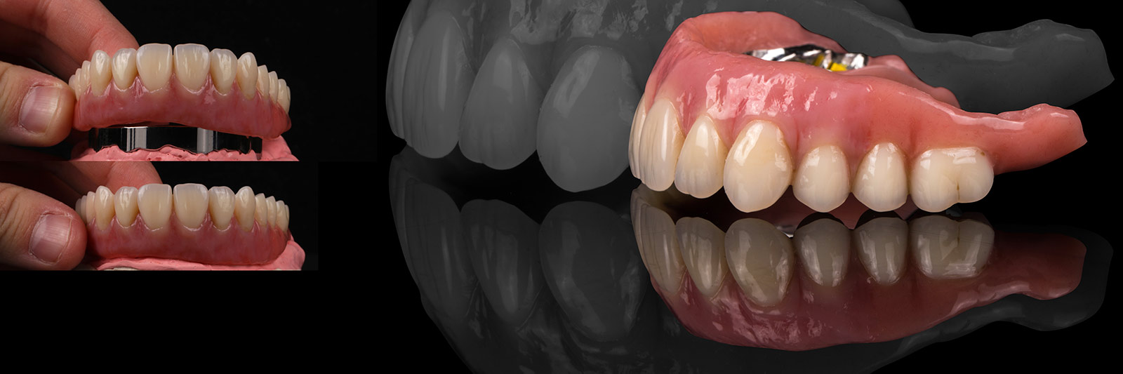 Unterschiedliche Ansichten einer Zahnprothese
