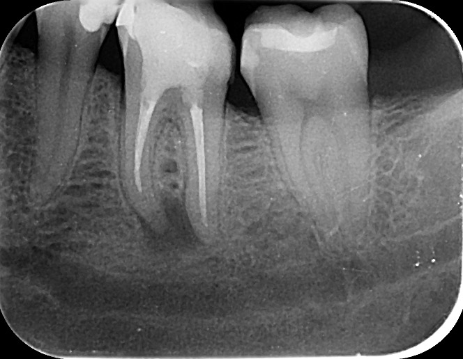 Röntgenbild Zahnwurzeln Großansicht